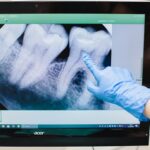 Intra-oral Scanner: Advanced Digital Dentistry Solution