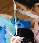 RCT in maruti dental clinics