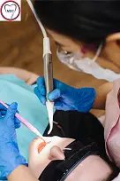 RCT in maruti dental clinics