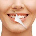 smile designers maruti dental clinic