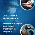 Best Dentist in Allahabad for RCT