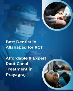Best Dentist in Allahabad for RCT