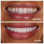 maruti dental clinic