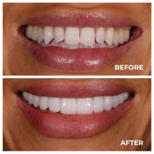 maruti dental clinic